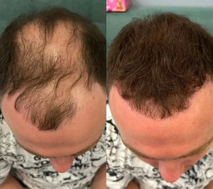 Poudre correctrice de densité capillaire pour hommes avec applicateur