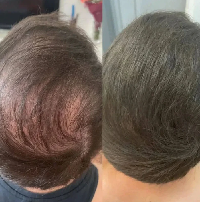Poudre correctrice de densité capillaire pour hommes avec applicateur
